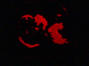 Ultrasound pumpkin